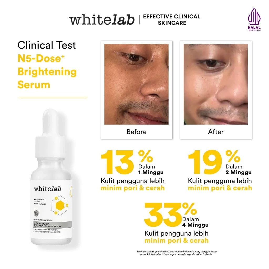 Whitelab Serum Niacinamide 5% Brightening Booster - Cerah Maksimal untuk Kulit Sensitif N5-Dose+ 2.0