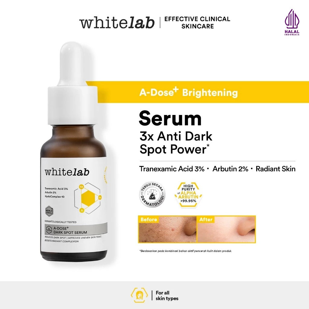 Whitelab Serum Arbutin Anti Dark Spot Flek Hitam - Serum Glowing Pencerah Wajah Bekas Jerawat