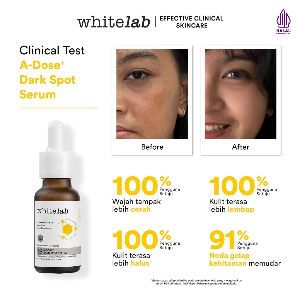 Whitelab Serum Arbutin Anti Dark Spot Flek Hitam - Serum Glowing Pencerah Wajah Bekas Jerawat