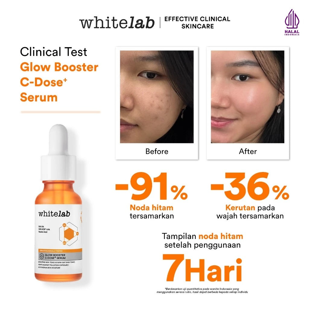 Whitelab Serum Vitamin C Glow Booster - Antioksidan Tinggi untuk Kulit Cerah dan Glowing C-Dose+ dengan NIO-VCS