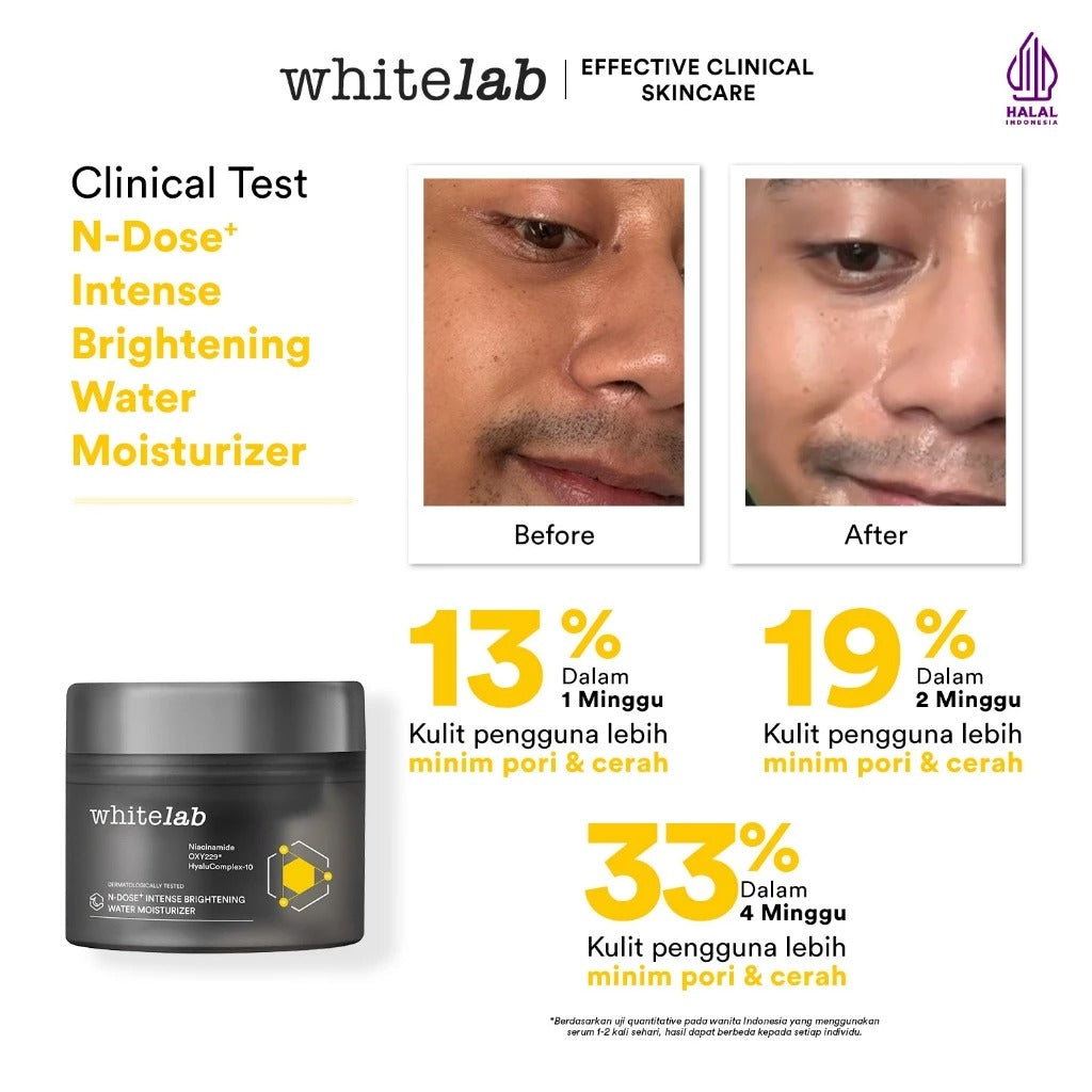 Whitelab Water Moisturizer Brightening - Pelembap Hidrasi Pencerah Wajah N-Dose+ 2.0