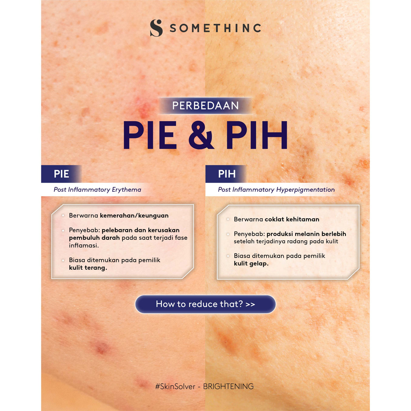 Somethinc Dark Spot Reducer Ampoule 20ml