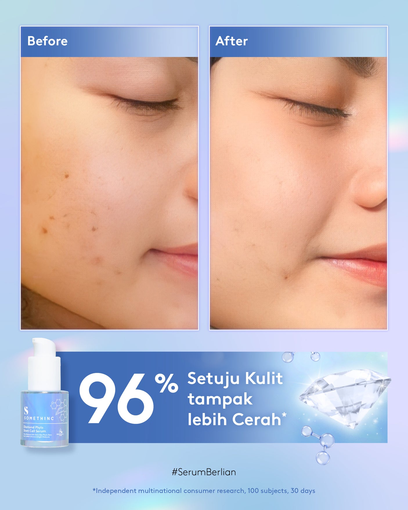 Diamond Phyto Stem Cell Serum 20ml