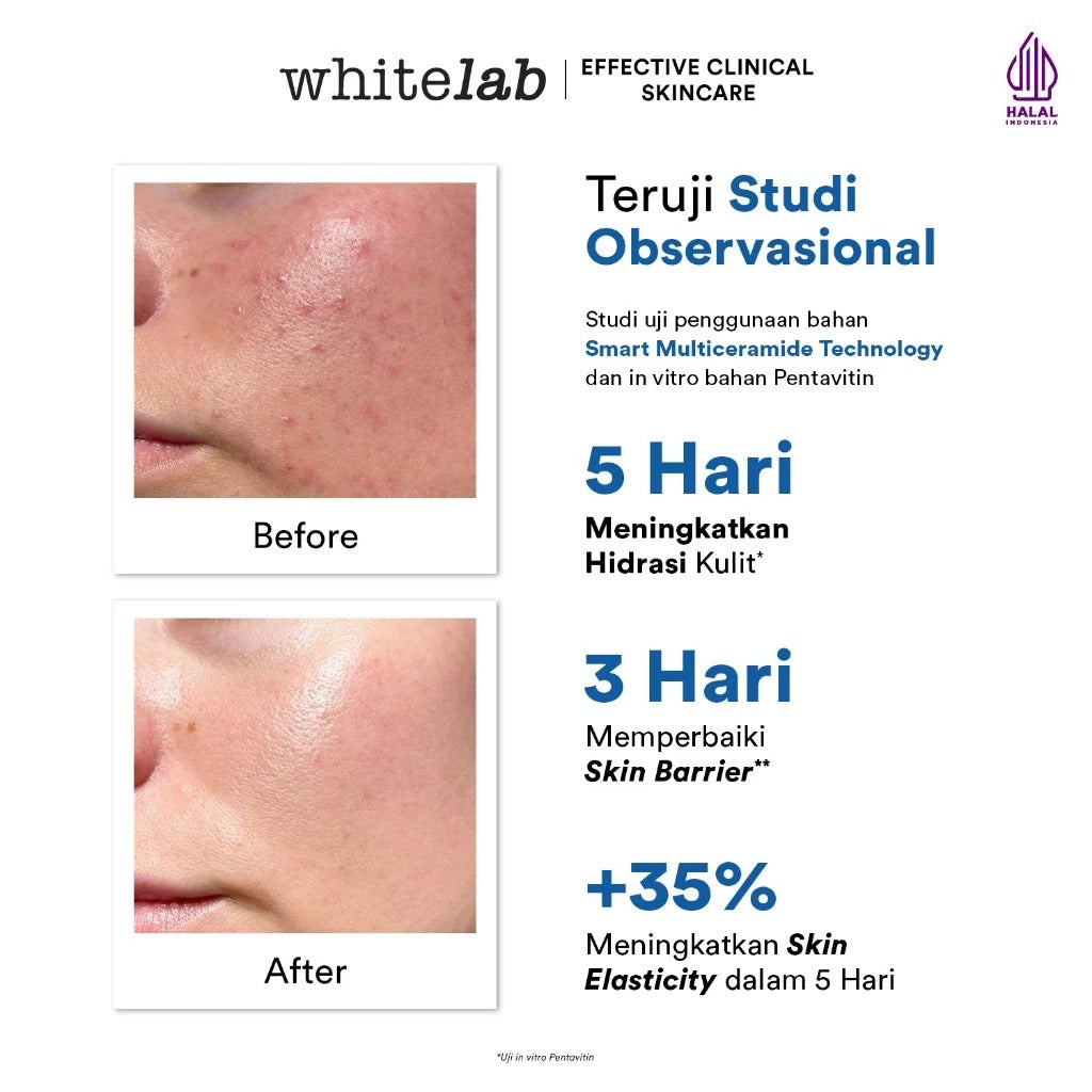 Whitelab Ceramug Barrier Water Moisturizer - Pelembap Kulit Wajah Kering Perbaiki Skin Barrier Siang Malam dengan Ceramide [BPOM] 20gr