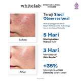 Whitelab Ceramug Barrier Water Moisturizer - Pelembap Kulit Wajah Kering Perbaiki Skin Barrier Siang Malam dengan Ceramide [BPOM] 20gr