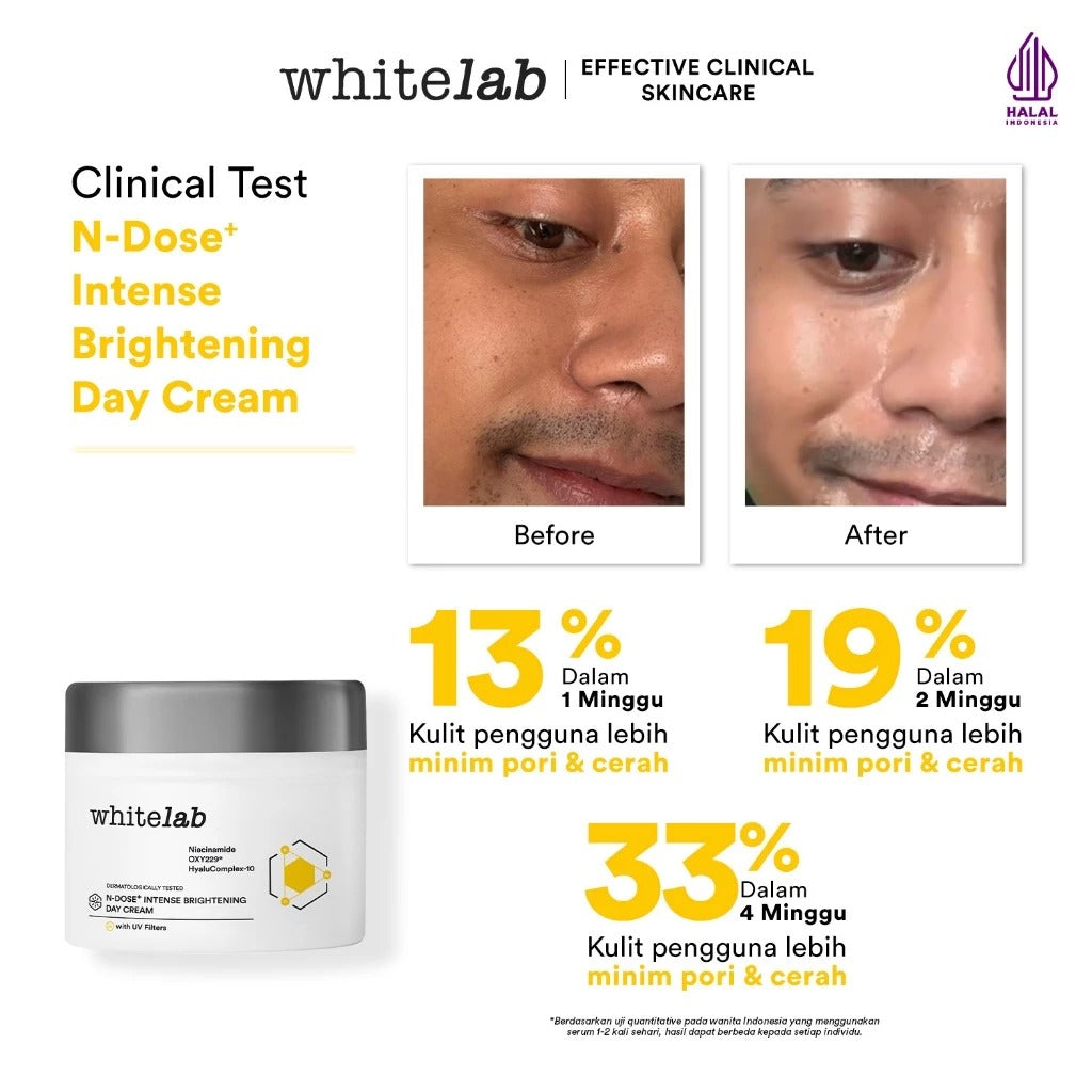 Whitelab Day Cream Brightening - Pelembap Krim Pagi Pencerah Wajah Untuk Kulit Oily N-Dose+ 2.0